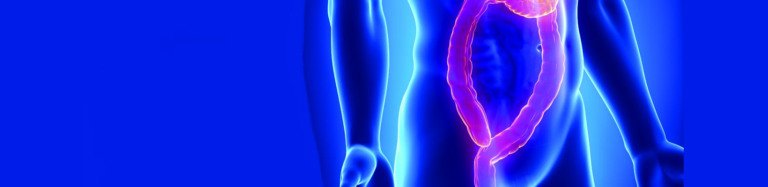 How effective is ColonView – ColonView